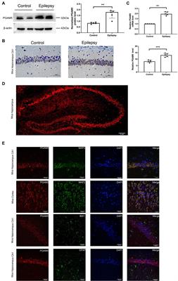 The inhibition of PGAM5 suppresses seizures in a kainate-induced epilepsy model via mitophagy reduction